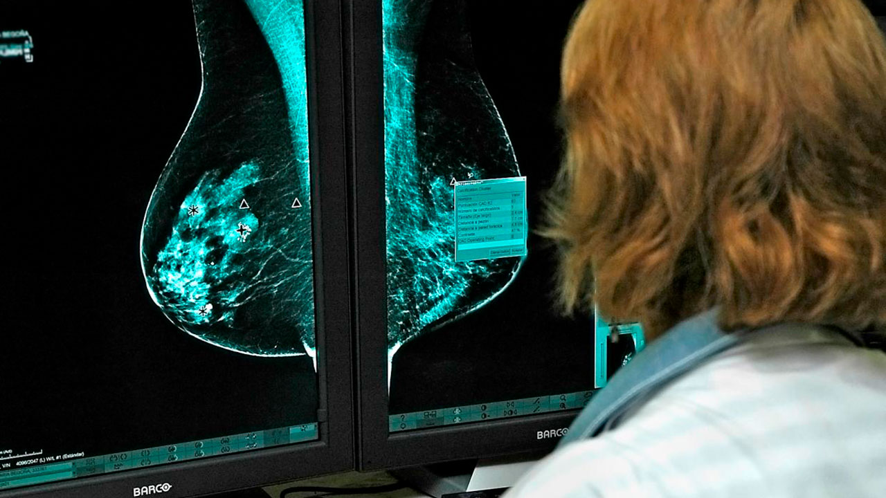 El Hospital General Universitario de Ciudad Real realiza más de 800 mamografías con tecnología 3D en el último trimestre 