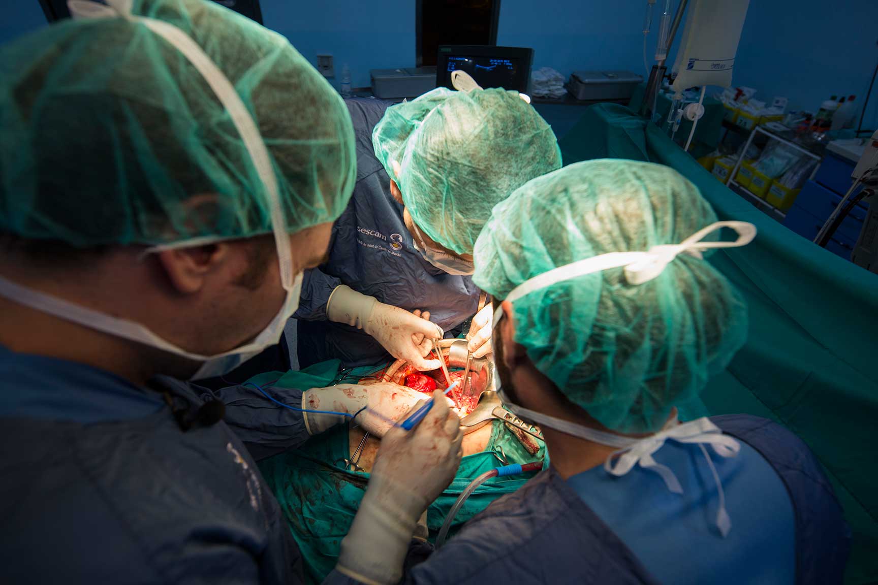 El Hospital de Toledo introduce la cirugí­a laparoscópica para extirpar tumores malignos de hí­gado