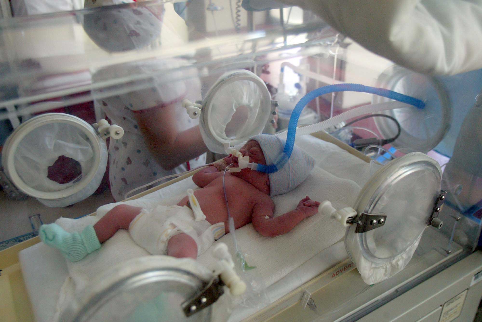 El servicio de Ginecologí­a y Obstetricia del Hospital de Guadalajara participa en un estudio para la prevención de los partos prematuros 